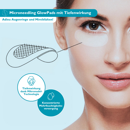 Microneedling GlowPads I Pads mit Mikronadel-Technologie gegen Augenringe und Mimikfalten